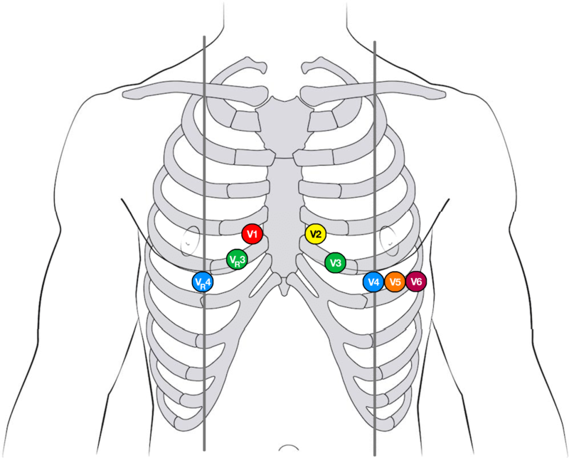 ECG – Pediatric Procedures